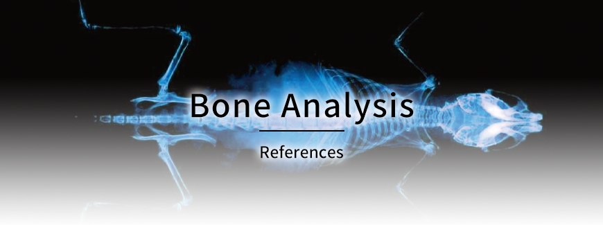 Bone Analysis