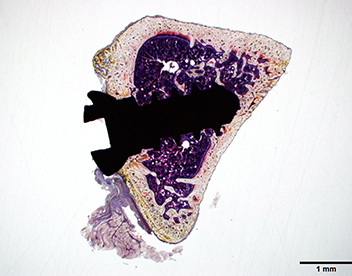 Villanueva Bone 染色 研磨標本（ラット脛骨＋インプラント）