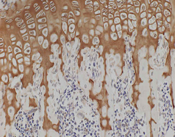 II型コラーゲン免疫染色（マウス脛骨）